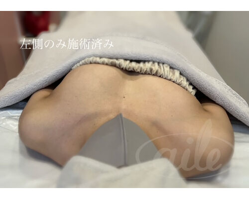 48ACF659-3CAF-487C-B063-5A0869AADE68