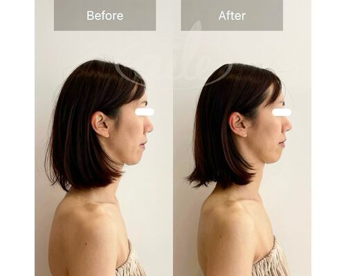 ECE0ECEC-4209-45AD-9F63-D4F3640663DC