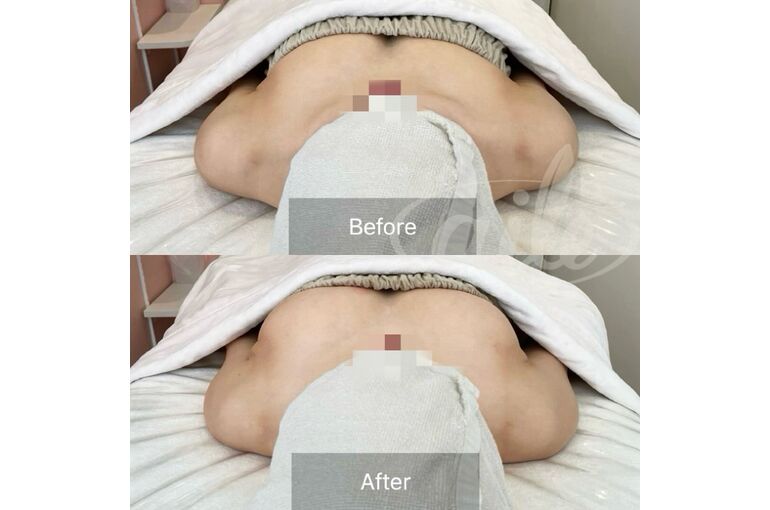 1B1803B0-FE9D-4D18-8C85-1891C0738B73