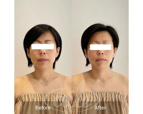 330018CA-9ADE-47A6-8881-69524A08EE13