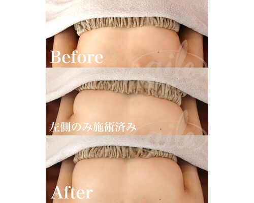 ミラクルバスト