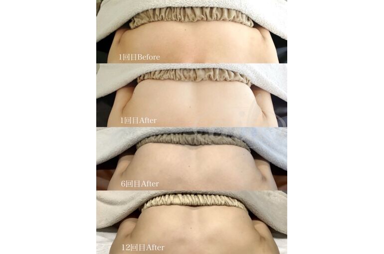 942B1854-FE79-4E43-B5C4-01DE3F98B56C