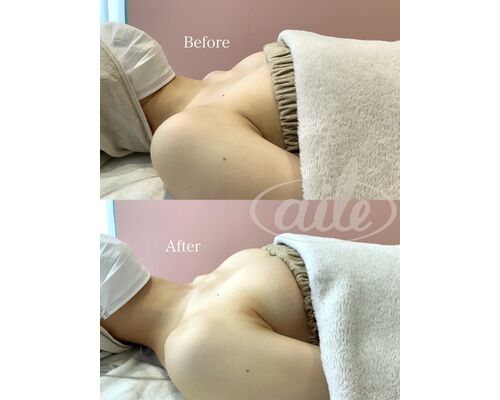 BF564D2B-2450-40D4-9D52-EA4BF8C9F80D